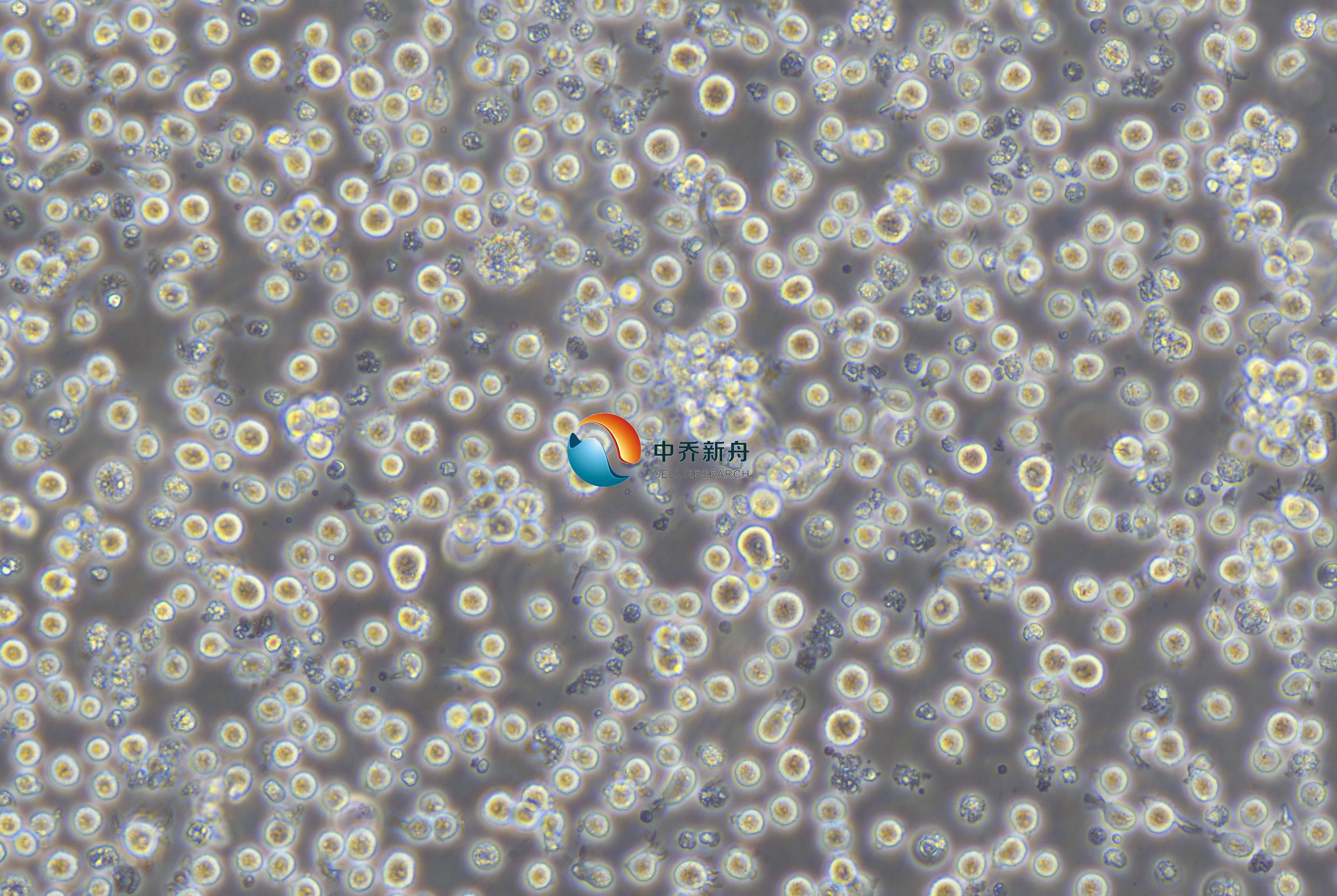 Raji-GFP+LUC人Burkitt's淋巴瘤细胞-绿色标记+荧光素酶标记