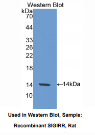 https://msimg.bioon.com/bionline/goods-no-pic.png