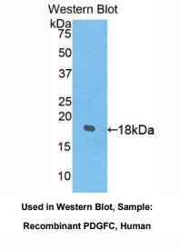 人血小板衍生生长因子C(PDGFC)多克隆抗体