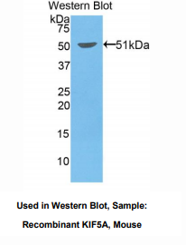 https://msimg.bioon.com/bionline/goods-no-pic.png