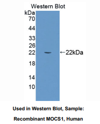 https://msimg.bioon.com/bionline/goods-no-pic.png