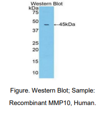 https://msimg.bioon.com/bionline/goods-no-pic.png