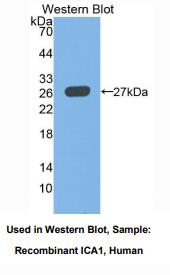 人胰岛细胞自身抗原1(ICA1)多克隆抗体