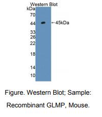 小鼠糖化溶酶体膜蛋白(GLMP)多克隆抗体