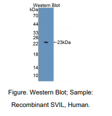 人监理蛋白(SVIL)多克隆抗体