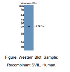 https://msimg.bioon.com/bionline/goods-no-pic.png