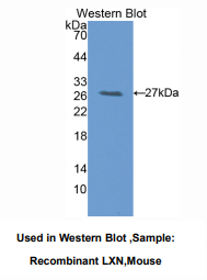 https://msimg.bioon.com/bionline/goods-no-pic.png