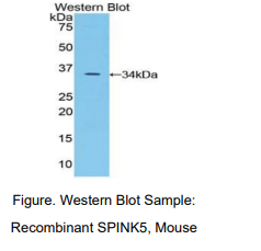 https://msimg.bioon.com/bionline/goods-no-pic.png