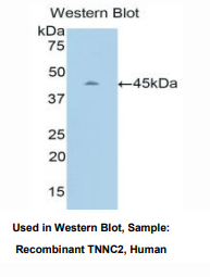 https://msimg.bioon.com/bionline/goods-no-pic.png