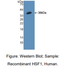 人热休克转录因子1(HSF1)多克隆抗体