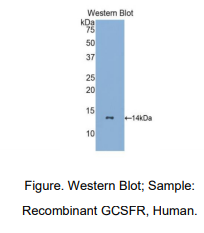 人粒细胞集落刺激因子受体(GCSFR)多克隆抗体