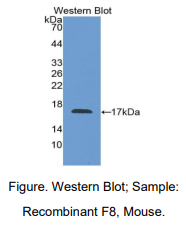 https://msimg.bioon.com/bionline/goods-no-pic.png