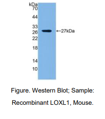 https://msimg.bioon.com/bionline/goods-no-pic.png