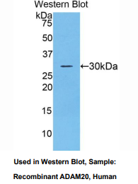 人解整合素金属蛋白酶20(ADAM20)多克隆抗体