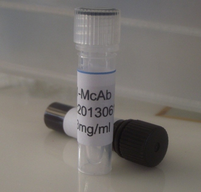 https://img.medsci.cn/ddcde1e7b2e0e108e468875510e7fab63610d4f3ca7f516c873b77eef8605285.jpg