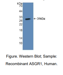 人去唾液酸糖蛋白受体1(ASGR1)多克隆抗体