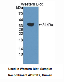 https://msimg.bioon.com/bionline/goods-no-pic.png