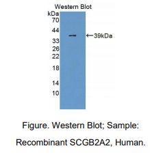 人分泌球蛋白家族2A成员2(SCGB2A2)多克隆抗体