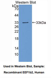 人真核翻译延伸因子1β2(EEF1b2)多克隆抗体