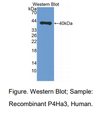 https://msimg.bioon.com/bionline/goods-no-pic.png