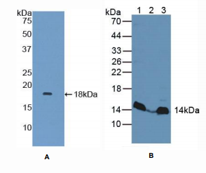 人丝裂原激活蛋白激酶支架蛋白1(MAPKSP1)多克隆抗体