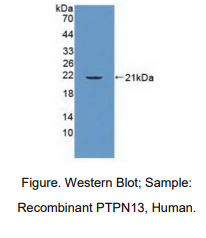 https://msimg.bioon.com/bionline/goods-no-pic.png