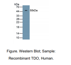 人色氨酸-2,3-双加氧酶(TDO)多克隆抗体