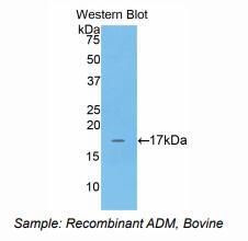 牛肾上腺髓质素(ADM)多克隆抗体