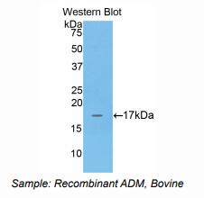 https://msimg.bioon.com/bionline/goods-no-pic.png