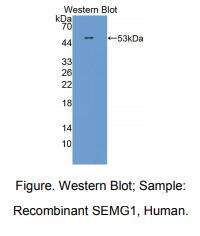 https://msimg.bioon.com/bionline/goods-no-pic.png