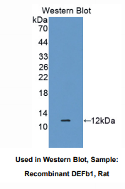 大鼠防御素β1(DEFb1)多克隆抗体