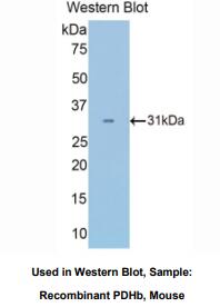 小鼠丙酮酸脱氢酶β(PDHb)多克隆抗体