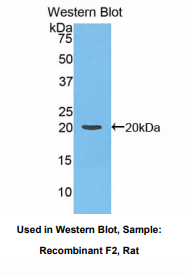 https://msimg.bioon.com/bionline/goods-no-pic.png