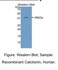 https://msimg.bioon.com/bionline/goods-no-pic.png