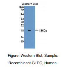 https://msimg.bioon.com/bionline/goods-no-pic.png