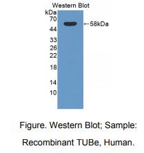 https://msimg.bioon.com/bionline/goods-no-pic.png