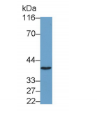 https://msimg.bioon.com/bionline/goods-no-pic.png