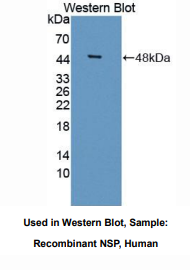 https://msimg.bioon.com/bionline/goods-no-pic.png