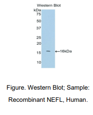 人轻肽神经丝蛋白(NEFL)多克隆抗体