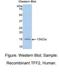 人三叶因子2(TFF2)多克隆抗体