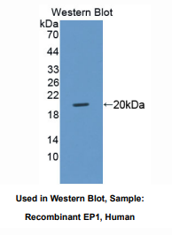 https://msimg.bioon.com/bionline/goods-no-pic.png