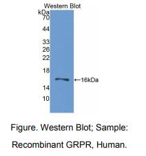 https://msimg.bioon.com/bionline/goods-no-pic.png