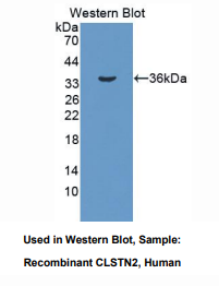 https://msimg.bioon.com/bionline/goods-no-pic.png