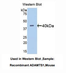 https://msimg.bioon.com/bionline/goods-no-pic.png