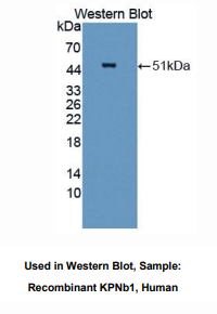 人亲核素β(KPNb1)多克隆抗体