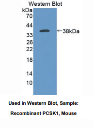 https://msimg.bioon.com/bionline/goods-no-pic.png