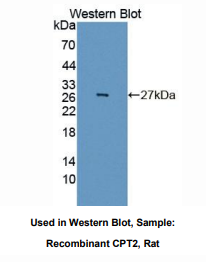 https://msimg.bioon.com/bionline/goods-no-pic.png