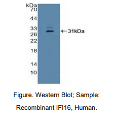 人干扰素γ诱导蛋白16(IFI16)多克隆抗体