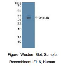 https://msimg.bioon.com/bionline/goods-no-pic.png