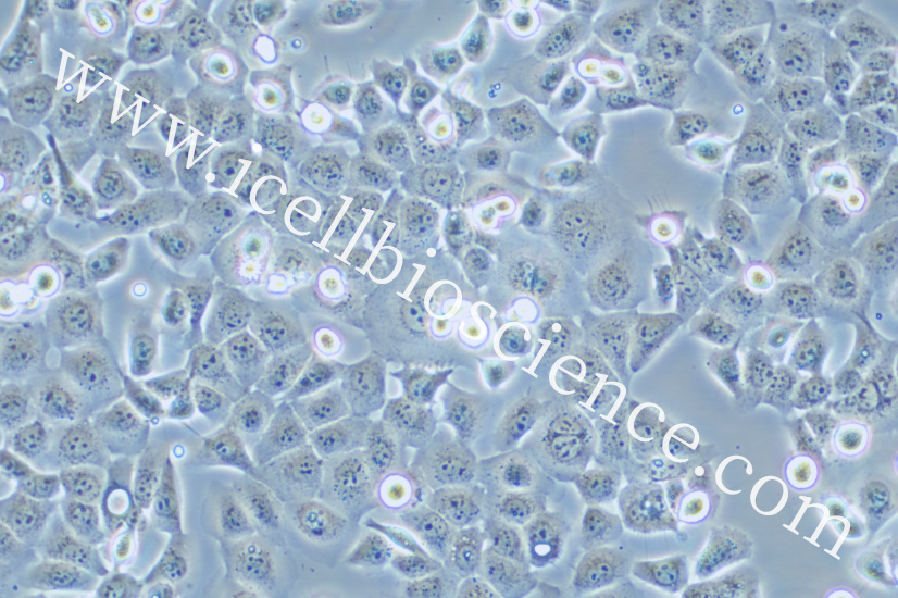 C643细胞/C-643细胞/C-643/C643/人甲状腺癌细胞（未分化）